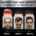 Moving Hair Growth Treatment, Repair Frizzy, Smooth And Dense Hair Scalp Care Heating Massage Cap