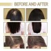 Rosemary Dense Hair Essential Oil, Prevent Hair Loss, Repair Frizz And Dry Hair Dense Hair Essential Oil