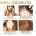 Rosemary Dense Hair Essential Oil, Prevent Hair Loss, Repair Frizz And Dry Hair Dense Hair Essential Oil