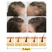 Ginger Dense Hair Soap, Moisturizes Hair Ends And Roots Cleansing Scalp Hair Care Shampoo Soap