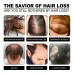 Ginger Dense Hair Soap, Moisturizes Hair Ends And Roots Cleansing Scalp Hair Care Shampoo Soap