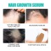 Hair Growth Serum, Repair Moisturize Dry Short-Tempered Out Prevention Strengthen Hair, The Hair Thick Care