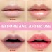 Lip Exfoliating Scrub, Lighten Lip Lines, Remove Dead Skin And Moisturizing Treatment Lip Mask