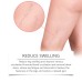 Leg Treatment Spray Leg Massage Treatment Spray Herbal Essence Moisturizes And Pamper The Legs Leg Treatment Spray Leg Massage Treatment Spray Herbal Essence Moisturizes And Pamper The Legs