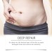 Ouhoe Skin Treatment Post-Natal Body Skin Repair Oil Moisturizing And Moisturizing Oil