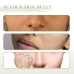 Repairing Melanin Serum, Lighten Dark Circles, Moisturize, Lighten Complexion And Improve Facial Dullness