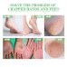 Dry Crack Protection Moisturizing Cream, Moisturizing And Hydrating Hand And Foot Repair Skin Care Cream