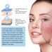 Hyaluronic Acid Face Serum, Moisturizing Repair Lighten Acne Mark Skin Care Whitening Essence