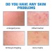 Hyaluronic Acid Face Serum, Moisturizing Repair Lighten Acne Mark Skin Care Whitening Essence