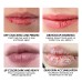 Moisturizing Lip Balm, Lighten Lip Lines, Prevent Dry Cracks, Peel, Remove Dead Skin, Volumizing Lip Lip Balm