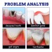 Oral Care Spray Pamper Teeth Soothe Teeth Discomfort Gentle Care Oral Spray