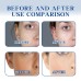 Ouhoe Brightening Cream Brightening Complexion Lightening Facial Spots Hydrating Moisturizing Firming And Tender Skin Cream