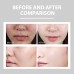 Hydrating Cream Hydrating And Lightening Facial Acne Repair Redness Hydrating And Brightening Moisturizing Cream
