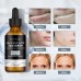 Salicylic Acid Facial Essence, Lighten Acne Mark Repair Hydrating Facial Care Essence