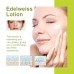 Edelweiss Lotion, Moisturizing And Brightening Face Dull And Shiny Skin Moisturizing Lotion Edelweiss Lotion, Moisturizing And Brightening Face Dull And Shiny Skin Moisturizing Lotion