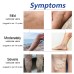 HouKea Heating Leg Cover, Relieve Lymphatic Swelling Venous Care Smooth Blood Vessel Bulges Warm Warm Leg Cover