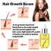 Hair Growth Serum, Prevent Fixation And Nourish Thick Hair And Scalp Hair Growth Serum, Prevent Fixation And Nourish Thick Hair And Scalp