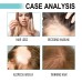 Multi-Peptide Serum For Hair Density, Fall Prevention Dense Hair Repair Damaged Hair Supple Hair Moist Hair Hair Oil