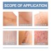 Oceaura Scar Whitening Repair Gel Moisturizes And Smooths Skin Repair Surgery Scar Pregnancy Care Gel