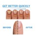 Nighttime Fungal Nail Treatment Patch, Repair Hand And Foot Inlay Rotten Nails Thickening Gray Nail Polish Care Patch