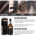 Hair Growth Essential Oil, Dense Hair Growth Repair Dry Hair And Moisture Hair Essence