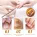 EELHOE Instant Cuticle Treatment Gel Repair Gray Nails Soft Nails Rotten Nails Dead Skin Moisturizing Treatment