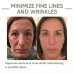 OUHOE Avocado Anti-Wrinkle Serum, Firming Facial Skin, Anti-Aging, Lightening Fine Lines, Moisturizing Skin Care