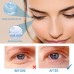 Retinol Eye Cream For Wrinkles Reduces Fine Lines, Dark Circles And Bags Under Eyes