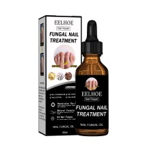 Nail Repair Solution Thickening Brightening Nails Removing Gray Nails Dead Skin Repair Nourishing Nail Care Solution