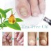 Nail Repair Pen Hand And Foot Gray Nails Cleaning Soft Nails Rotten Nails Thickening Nails Shining Nails Treatment