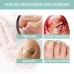 Nail Repair Pen Hand And Foot Gray Nails Cleaning Soft Nails Rotten Nails Thickening Nails Shining Nails Treatment