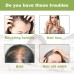 EELHOE Rosemary Dense Hair Spray Hydrates Roots For Increased Elasticity Restoring Shine Anti-Set Hair Spray