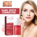 Hoygi Dark Spots Repair Essence, Moisturizing And Brightening Repair Essence For Dark Spots And Age Spots