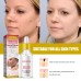 EELHOE Wart Essence Removes Dark Moles Flesh Moles Repair Skin Neck Flesh Grains Flat Especially Corns Remove Warts