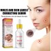 EELHOE Wart Essence Removes Dark Moles Flesh Moles Repair Skin Neck Flesh Grains Flat Especially Corns Remove Warts