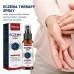 South Moon Eczema Therapy Spray, Repair Skin Redness And Itchiness Cowskin Moss Care Spray