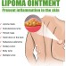 Fat Binding Cream, Dredge Body Of Many Kinds Of Fat Caking Tumor Subcutaneous Lumps Body Care Cream