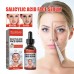 Salicylic Acid Facial Essence Hydrating Repair Improve Skin Care Essence Salicylic Acid Facial Essence Hydrating Repair Improve Skin Care Essence