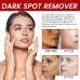 OUHOE Dark Spot Removal Cream, Moisturizing Repair Lighten Face Fine Lines And Spots Skin Whitening Cream