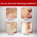 OUHOE Dark Spot Removal Cream, Moisturizing Repair Lighten Face Fine Lines And Spots Skin Whitening Cream