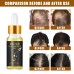 Hair Growth Oil, Strengthens And Strengthens Hair Essential Oil Softens And Moisturizes Hair And Thickens Hair Nutrient Solution