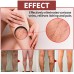 EELHOE Venous Massage Varicose Cream, Relieves Bulging Leg Blood Vessels And Swollen Leg Earthworm Venous Massage Cream EELHOE Venous Massage Varicose Cream, Relieves Bulging Leg Blood Vessels And Swollen Leg Earthworm Venous Massage Cream