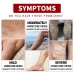 EELHOE Venous Massage Varicose Cream, Relieves Bulging Leg Blood Vessels And Swollen Leg Earthworm Venous Massage Cream EELHOE Venous Massage Varicose Cream, Relieves Bulging Leg Blood Vessels And Swollen Leg Earthworm Venous Massage Cream
