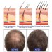 East Moon Men's Dense Hair Foam Machine, Repair Hair Root Follicle Men's Hair Thick Moisturizing Foam