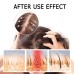 East Moon Boost Hair Serum, Prevent Hair Loss Strengthen Thicken And Nourish Hair Roots Hair Care Serum Set East Moon Boost Hair Serum, Prevent Hair Loss Strengthen Thicken And Nourish Hair Roots Hair Care Serum Set