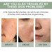 Hoygi Pore Deep Cleansing Foam, Deep Clean Facial Skin Shine Bright Moist Blain To Imprint Clear Water
