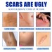 Jaysuing Scar Cream, Fade Scars Smooth And Firming Skin Repair Cream