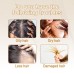 Googeer Hair Regrowth Drops, Repair Dry Hair Smooth Hair Solid Hair Thick Prevent Hair Loss