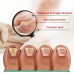 OUHOE Nail Care Soft Nail Care Daily Clean Gentle Maintenance Moisturizing Nail Care Solution OUHOE Nail Care Soft Nail Care Daily Clean Gentle Maintenance Moisturizing Nail Care Solution