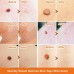 Flat and sharp warts, with a warm and moisturizing facial warts remover